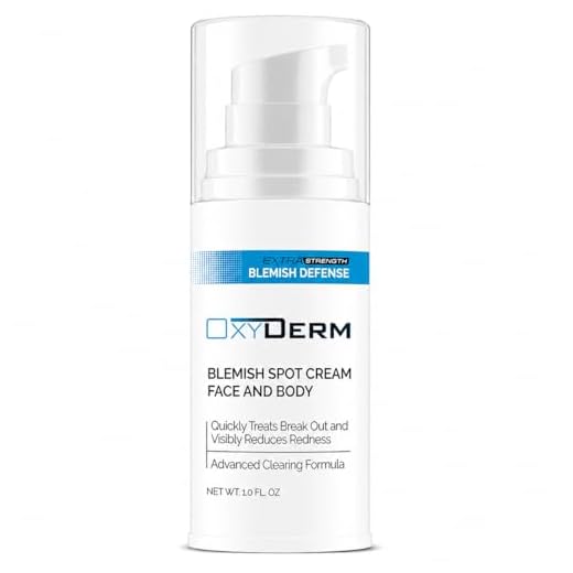 Acne Face & Body Cream- Extra Strength Fast Acting Formula. Clears Away Pimples, Whiteheads, Blackheads, Cystic Acne, Dark Spots, Acne Scars, Clogged Pores for Teens, Adults, Men & Women.