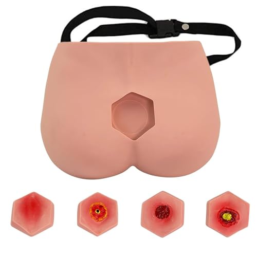 Modelo de entrenamiento clínico para simulación de úlcera por decúbito y úlcera por presión, kit de cuidado de heridas de glúteos portátil, diseño reemplazable para educación de enfermería