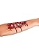 Open Wound Scar