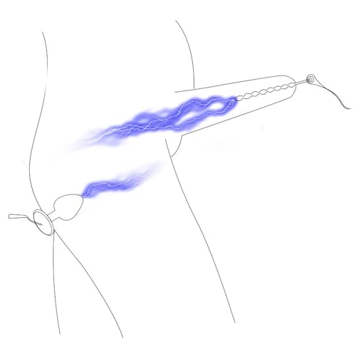 Stimuler le point G et la prostate grâce au plug anal électrostimulation