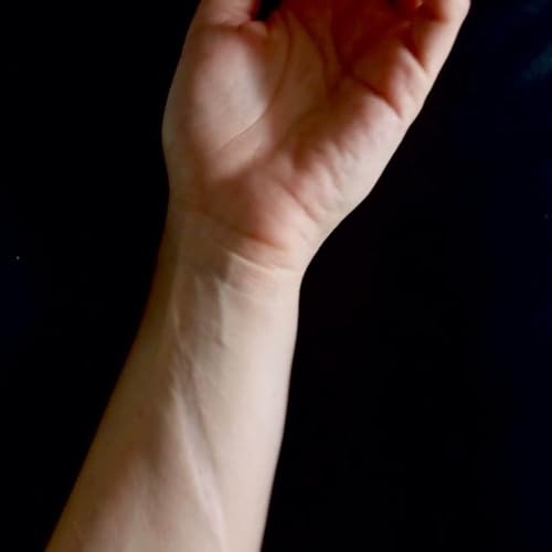 " Cr&eacute;er pour cicatriser "