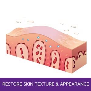 Miniatura 7 de Hidratante antipicazón (3 oz) Alivia rápidamente la picazón, la irritación y la sequedad de la piel o el cuero cabelludo. Alivia la picazón