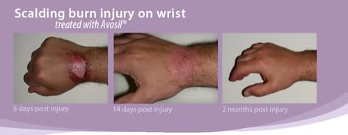 Intensive Scar Cream, Formulated with Next Generation Polymer Technology, for Old & New Scars, Surgical Scars, and Burns, Fades Discoloration, Soothes Itchy and Irritated Scars (4 oz)