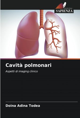 Cavità polmonari: Aspetti di imaging clinico