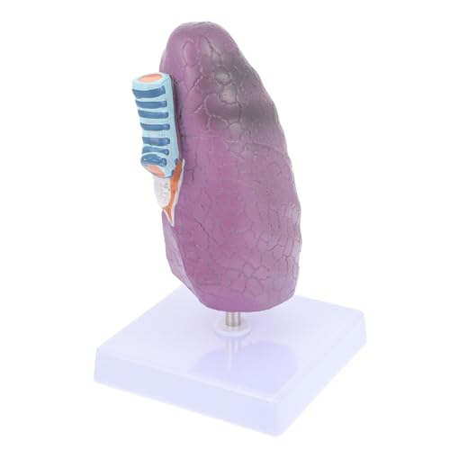 Modèle de poumon en plastique ABOOFAN pathologique et outil éducatif