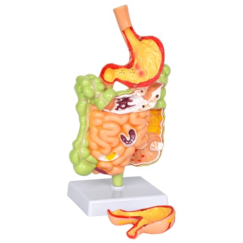 Simedutech Human Stomach Anatomy Model, Large Small Intestine Anatomy Removerable Teaching Model, for Medical Students Education Study Assisted Dissection Suitable for Teaching Anatomy Class