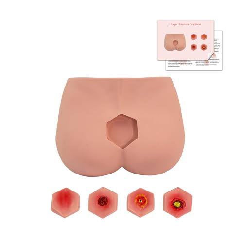 Decubitus Ulcer Training Model, PVC Bedsores Pressure Sore Model 4 Stages of Bedsores - Decubitus Wound Care Kit for Medical Pratice Training Teaching Model
