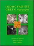 Indocyanine Green Angiography