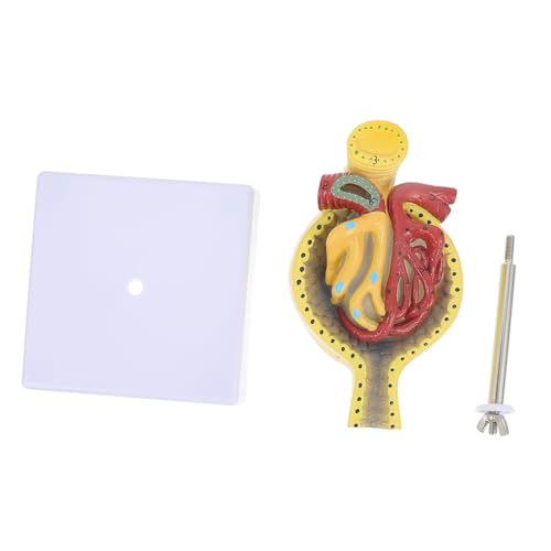 Modèle de glomérule médical CHILDWEET pour simplifier la compréhension de l'anatomie