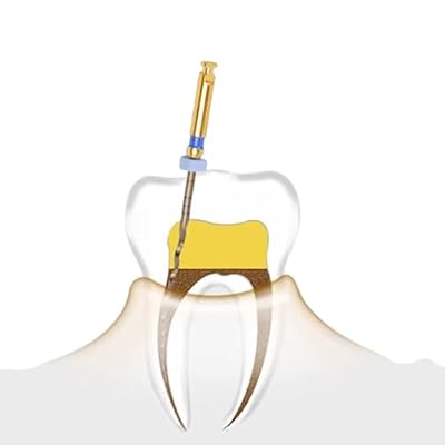 Dental Endo Rotary File X-Pro Gold Taper 12PCS Niti Endodontic Root Canal Files (2Packs 21MM Assort)
