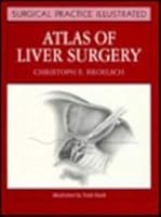 Atlas of Liver Surgery 0443087334 Book Cover