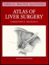 Hardcover Atlas of Liver Surgery (Surgical Practice Illustrated) Book