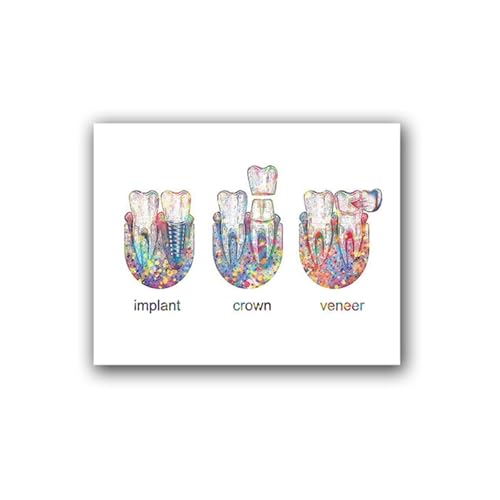 Implante de dientes arte corona Dental impresión dentista regalo anatomía de los dientes médico cuadro sobre lienzo for pared cuadro decoración de clínica Dental(PC1016,A4 21x30 cm No Frame)