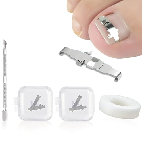 Esshogo 1 Satz Eingewachsene Zehennagel-Werkzeuge, Nagel-Korrekturschnalle, Patch Gebogene Zehennägel Klammer, Premium Edelstahl Maniküre Pediküre, Für Eingewachsene Paronychie-Behandlung