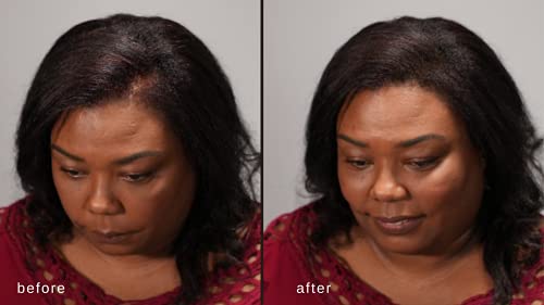 Maxx Pro-Series Volumizing Hair Fibers With Real Keratin For Thinning Hair/Hair Loss – Dermatologist Tested And Certified Hypoallergenic - 60 Days + Supply - Multiple Colors Available (Medium Blond) #TOP6