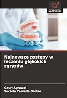 Najnowsze postepy w leczeniu glebokich zgryzów (Polish Edition) 6208952794 Book Cover