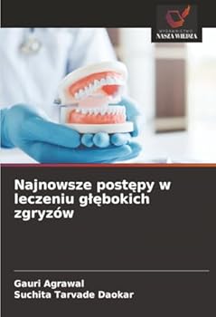 Najnowsze postepy w leczeniu glebokich zgryzów (Polish Edition)