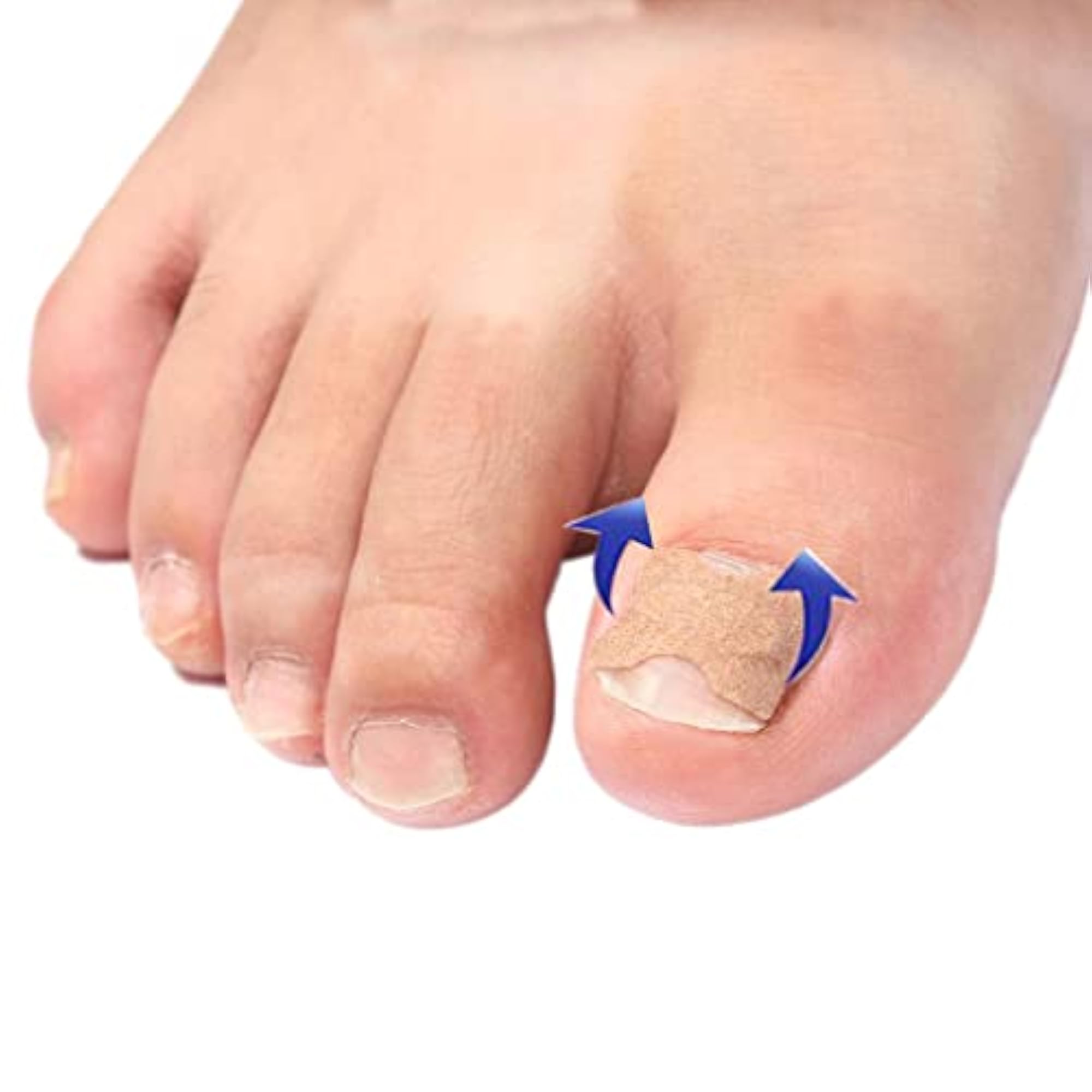 Ingrown Nail Repair Foot Corrector Stickers, 30Pcs