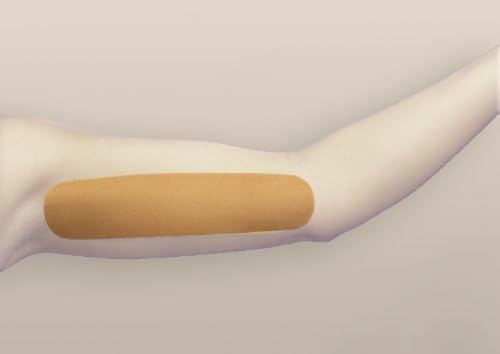 OleevaBrachioplasty Shape (Each) by Oleeva
