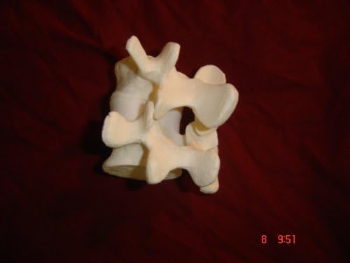 Lumbar L4-L5 Spinal Vertebrae Model
