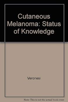 Hardcover Cutaneous Melanoma: Status of Knowledge Book