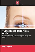 Tumores da superfície ocular (Portuguese Edition) 6207824423 Book Cover