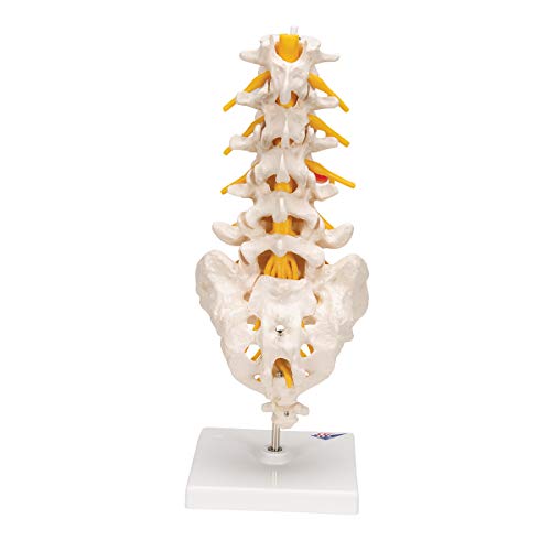 Image of 3B Scientific A76 /5 Lumbar Spinal Column with Dorso-Lateral Prolapsed Intervertebral Disc, 13.4 inch Height