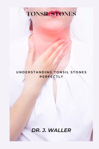 TONSIL STONES: UNDERSTANDING TONSIL STONES PERFECTLY