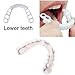 2 Pairs Temporary Smile Support Adjustable for All Genders - Natural Look & Comfort, Beautiful Smile Teeth Whitening Kits(White)