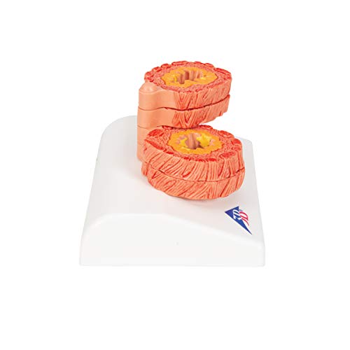 Image of 3B Scientific G50 /1 COPD Model - 3B Smart Anatomy