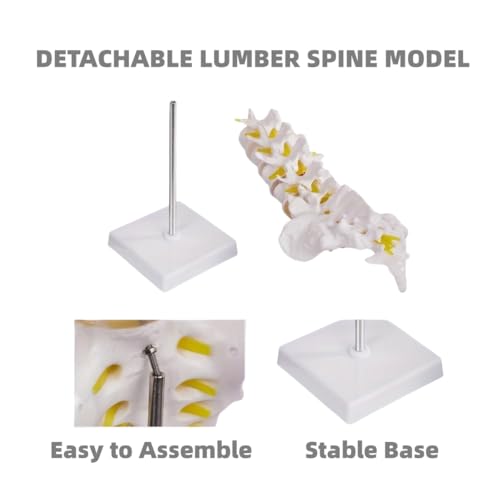 Image of Human Anatomical Lumbar Disc Herniation Model Life Size Lumbar Spine Model for Teaching and Learning (Spine-Tall)