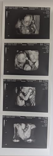 Prank 3D Customized Fake Ultrasound Strip of 4 Photos