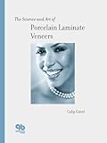 The Science and Art of Porcelain Laminate Veneers