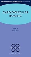 Algopix Similar Product 2 - Cardiovascular Imaging Oxford