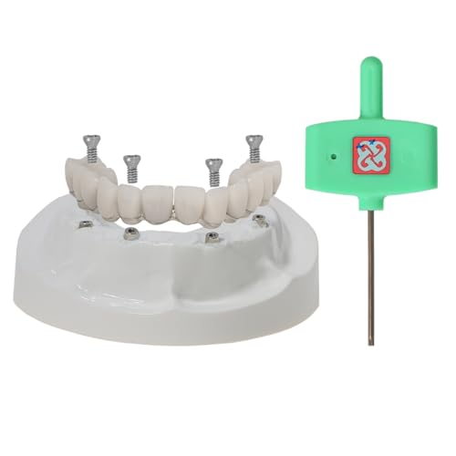 Dental Overdenture Model Upper Jaw Implant Restoration Model 4 Screws M6023