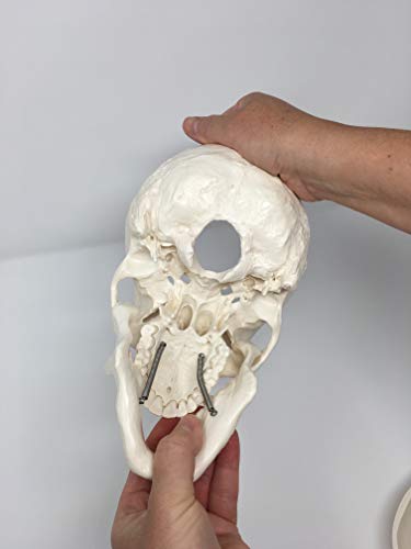 Medical Anatomical Skull Model - 3 Parts - Life Sized Human Mold #TOP6
