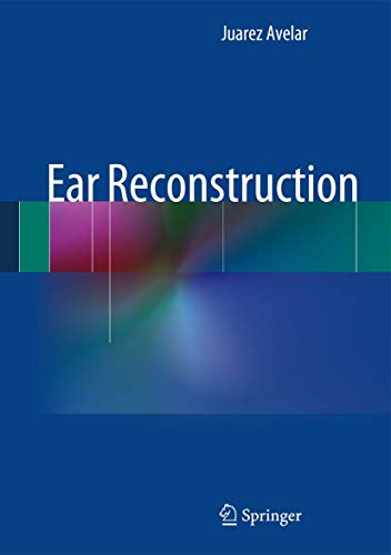 Ear Reconstruction view 2