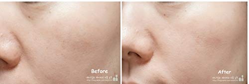 Miniatura 7 de DERMA TIES+T Led Máscara Auto Cuidado de la Piel 3 Modo de Longitud de Onda Cuidado del Hogar Equipo de Belleza Carga USB