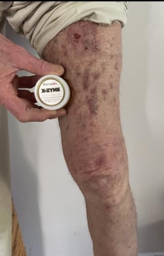 PHYTOMRX X-ZYME *Itch Cream *Anti-Aging Skin Care *Gets The Itch Out *Reverse Skin Damage. ****X-ZYME is a Moisturizer. It is NOT a substitute for seeing a Dermatologist****