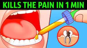 Anadent 853030002779 Toothache Gel, 20% Benzocaine Oral Gel For Instant Pain Relief thumb #3
