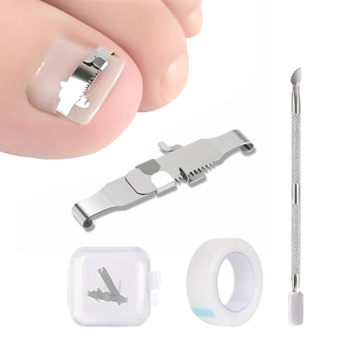 Ingrown Toenail Treatment Corrector Set, Wearable Stainless Steel Clip Buckle Ingrown Toenail Tool for Men Women Manicure and Pedicure Use Personal Care Toenail Pain Relief (L)