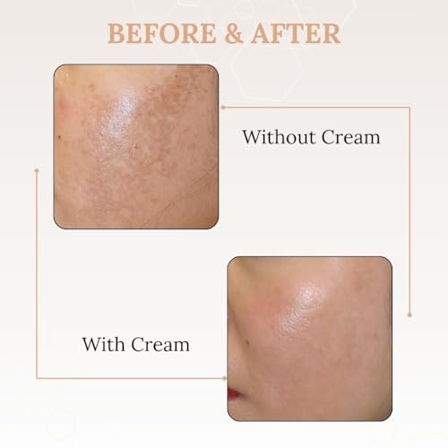 Image of Ocevia Skin Brightening Face Cream for Melasma, Hyper Pigmentation, Tanning and Dark Spot (30 gm) | Anti Aging Face Cream with Alpha-Arbutin and Niacinamide