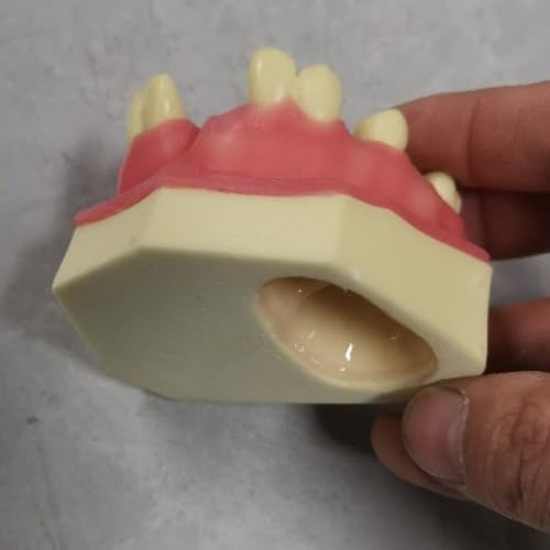 Modelo dental tipodonto para aprender restauración de sobredentaduras 6