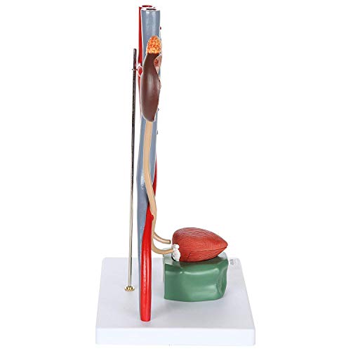 Teaching Model, Anatomy Model Body, Urinary System Model, 4-Parts, Dissected Structure Of Kidney | Internal Structure Of Bladder, Includ Kidneys With Adrenal Glands, Ureters, And Bladder Anatomy Biolo #TOP5