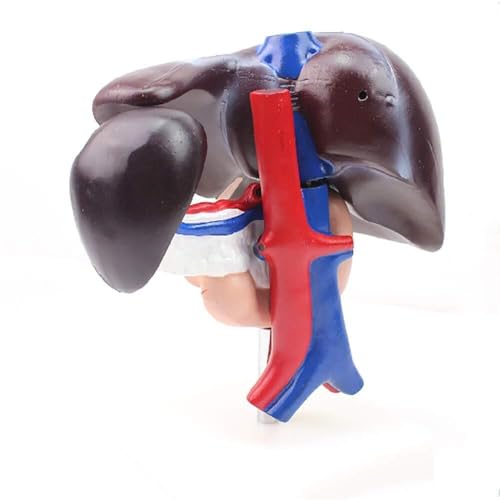 Modèle de pathologie du pancréas AMITD aide à l'apprentissage digestif en anatomie