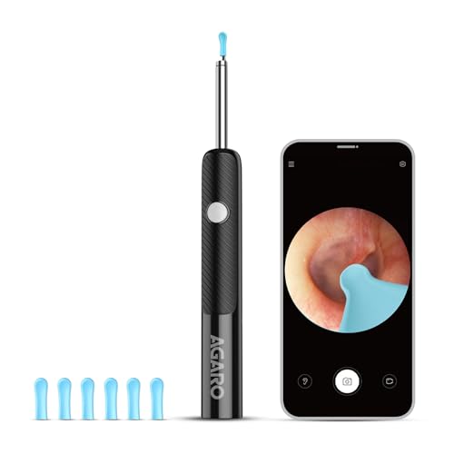 Image of AGARO Regal Ear Endoscope Cleaner /Earwax Removal Tool Kit with HD Camera, Light Weight, Type-C Charging, 130 mAh Battery, IP67 Waterproof, Wifi Connection for iOS & Android + 6 Silicone Tips