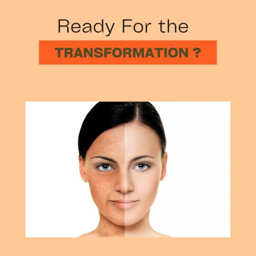 Fresh Dew Dark Spot Corrector Brightening Face Cream With Alpha Arbutin & Niacinamide | Helps Reducing Dark Spots, Sun Spots, Acne Marks | For Men and Women| 30gm