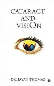 Vedi scheda su Amazon Cataract and Vision