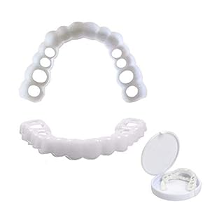 Tanden Socket-Perfect Braces en Whitening Alternative, Instant Smile Natural Flex Upper en Natural Shade Lower Veneers