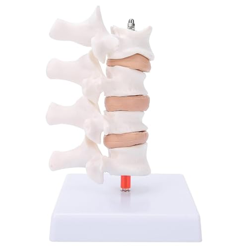 Modèle de spine pathologique lombaire AMITD en taille réelle avec base - 3